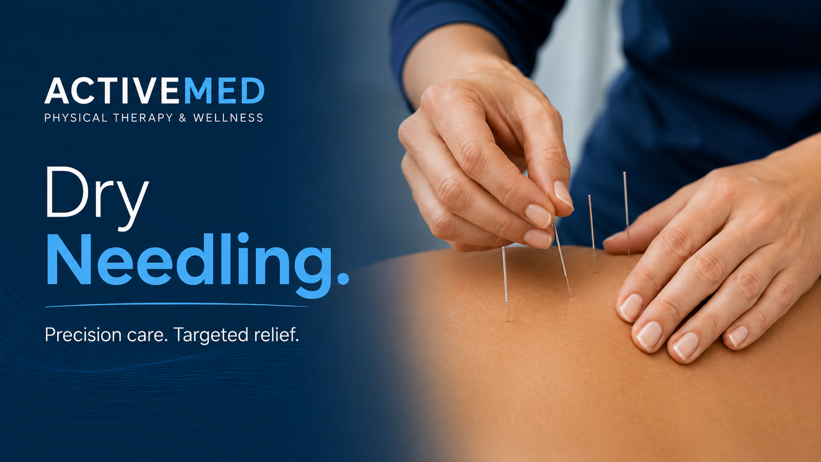 Dry needling treatment setup